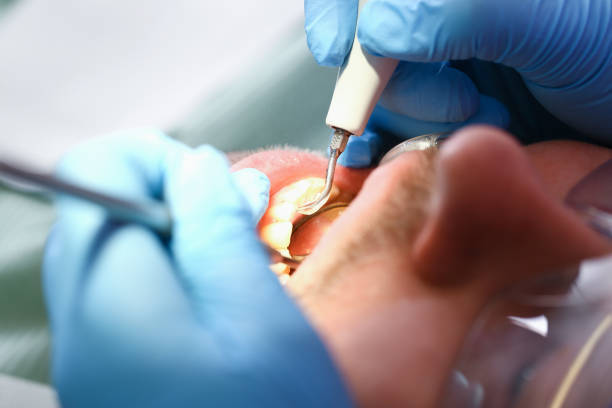 Best Emergency Treatment for Toothache in Montgomery, GA