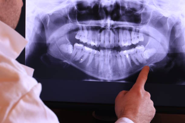 Best Emergency Treatment for Toothache in Montgomery, GA