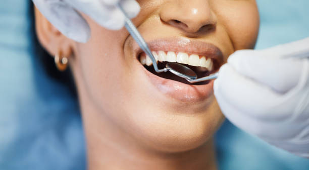 Best Emergency Treatment for Toothache in Montgomery, GA