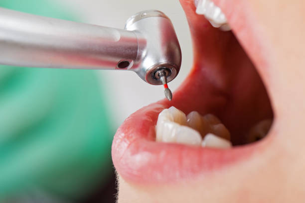 Best Pediatric Emergency Dentist in Montgomery, GA